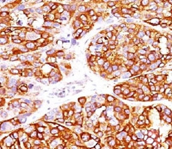 Recombinant MART-1 Antibody / Rabbit Monoclonal