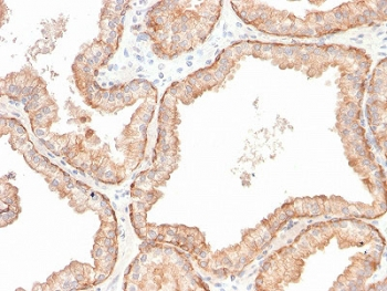 Recombinant IL-10 Antibody