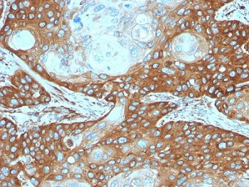 RPSA Antibody / 40S Ribosomal protein SA / Laminin Receptor 1
