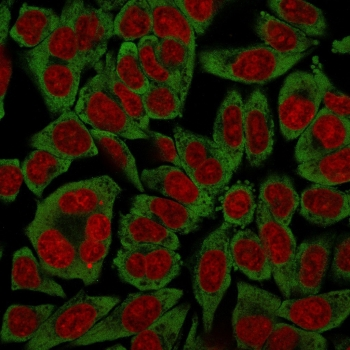RPSA Antibody / 40S Ribosomal protein SA / Laminin Receptor 1