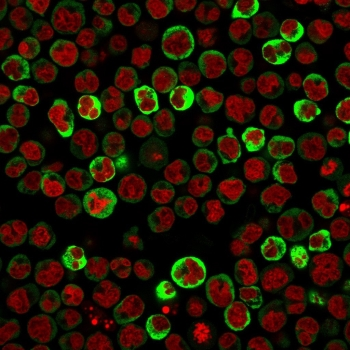 RPSA Antibody / 40S Ribosomal protein SA / Laminin Receptor 1
