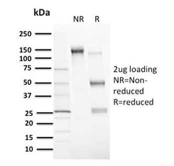 MDM2 Antibody