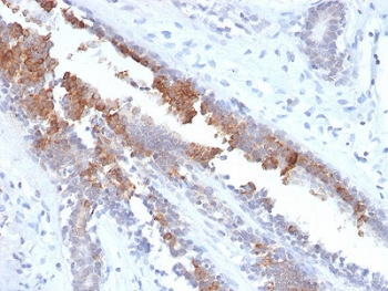 Recombinant Mammaglobin Antibody / SCGB2A2