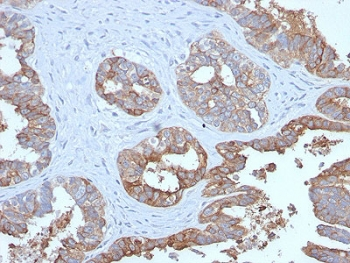 Recombinant MUC1 Antibody / Mucin-1