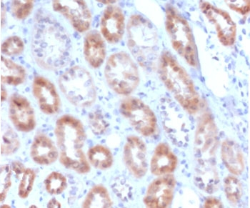 Recombinant MTAP Antibody / S-methyl-5'-thioadenosine phosphorylase