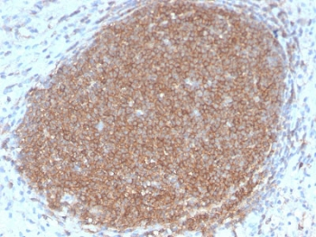 Recombinant CD45RB Antibody