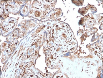 Recombinant S100A4 Antibody / FSP1