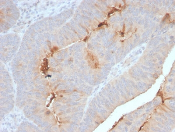 Recombinant SAA Antibody / SAA1 + SAA2