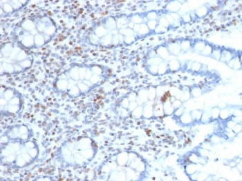 BMI1 Antibody