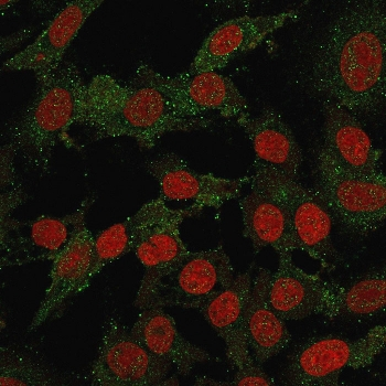 Recombinant B7-H4 Antibody / VTCN1