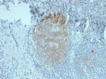 CD80 Antibody