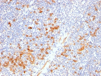 Recombinant CD123 Antibody / IL3RA