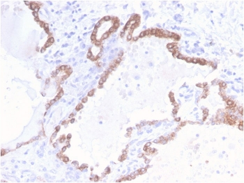 Recombinant CK18 Antibody / Cytokeratin 18