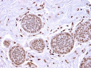 Recombinant Mammaglobin Antibody / SCGB2A2