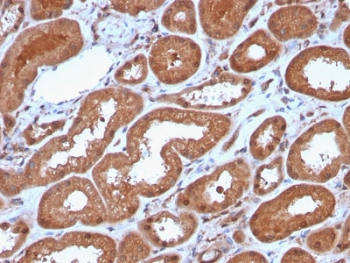 Recombinant MTAP Antibody / S-methyl-5'-thioadenosine phosphorylase