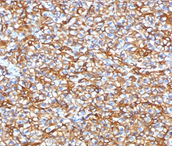 Recombinant SPTBN2 Antibody / Spectrin beta III