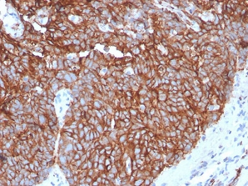 Recombinant GLUT1 Antibody