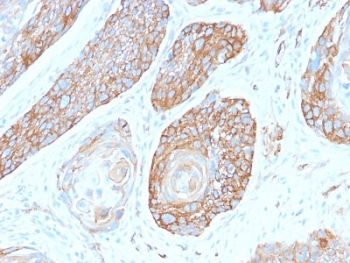 Recombinant Spectrin beta III Antibody / SPTBN2