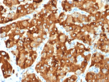 AMACR Antibody / p504S