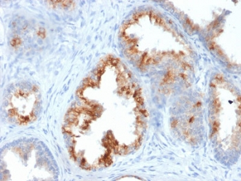 AMACR Antibody / p504S