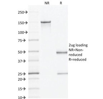 AMACR Antibody / p504S