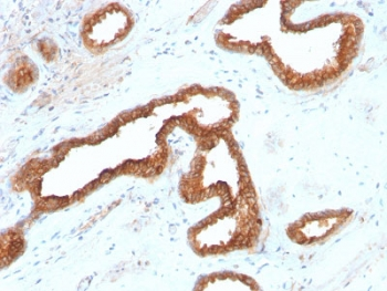 Recombinant AMACR Antibody / p504S