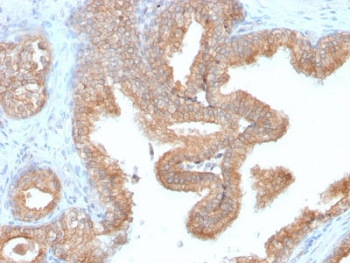 Recombinant AMACR Antibody / p504S