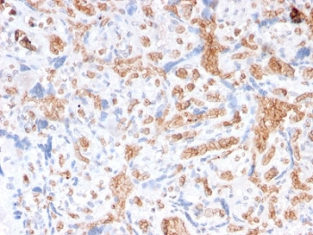Recombinant Spectrin alpha 1 Antibody / SPTA1