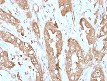 Recombinant Villin Antibody / VIL1