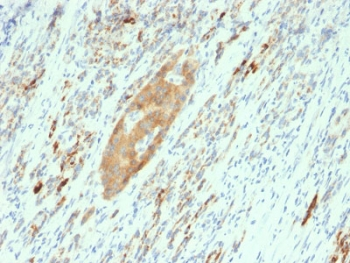 GAD65 Antibody / GAD2