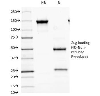 GAD65 Antibody / GAD2