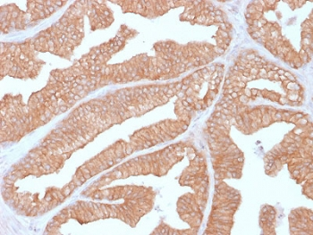 Calcineurin Antibody / PPP3CA