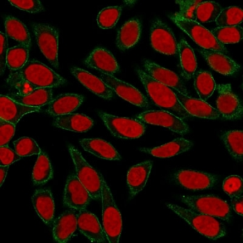 Recombinant Spectrin beta III Antibody / SPTBN2