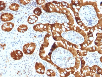 SULT1E1 Antibody / Estrogen Sulfotransferase