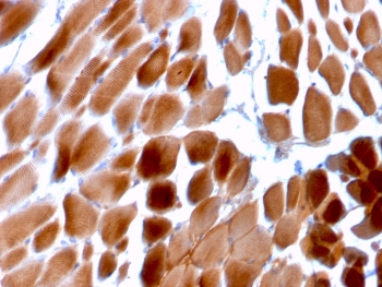 Sarcomeric Alpha Actinin Antibody / ACTN2