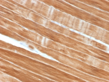 Sarcomeric Alpha Actinin Antibody / ACTN2