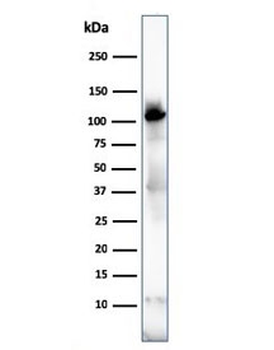 Sarcomeric Alpha Actinin Antibody / ACTN2