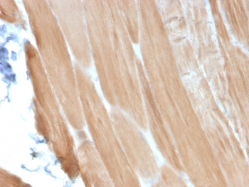 Sarcomeric Alpha Actinin Antibody / ACTN2
