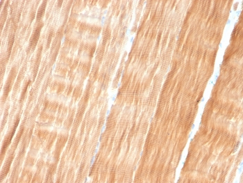 Sarcomeric Alpha Actinin Antibody / ACTN2