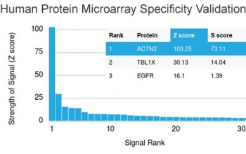 Sarcomeric Alpha Actinin Antibody / ACTN2