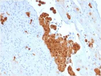 Calbindin 2 Antibody / CALB2 / Calretinin