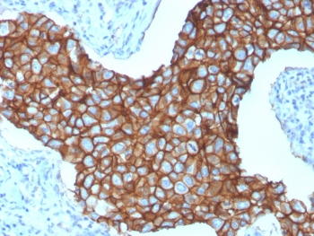 HER-2 Antibody / ErbB2