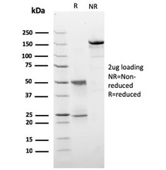 HER-2 Antibody / ErbB2