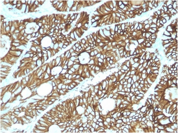 Cadherin 17 Antibody