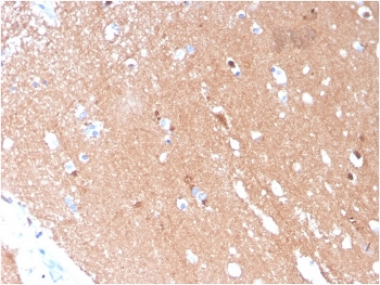 TUBB3 Antibody / Beta Tubulin
