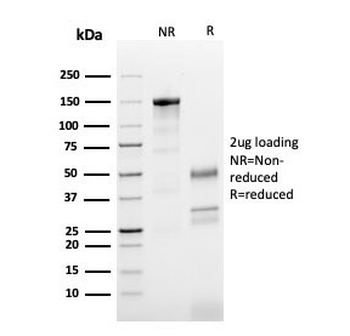 TUBB3 Antibody / Beta Tubulin