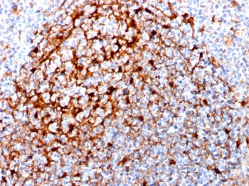 Cystatin A Antibody / CSTA