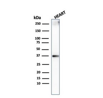 Recombinant Histone H1 Antibody