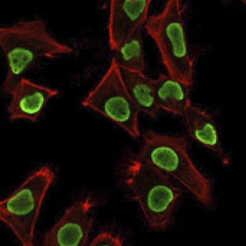 Recombinant Histone H1 Antibody