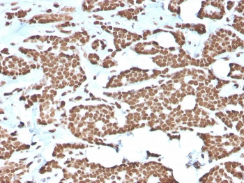 Recombinant Histone H1 Antibody